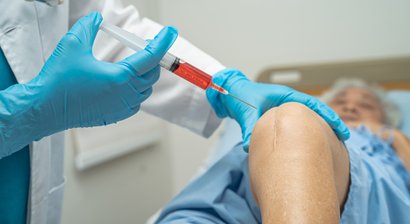 Hyalurontherapie bei gering- bis mittelgradigem Gelenkverschleiß und als Kombinationstherapie zur Stammzelltherapie