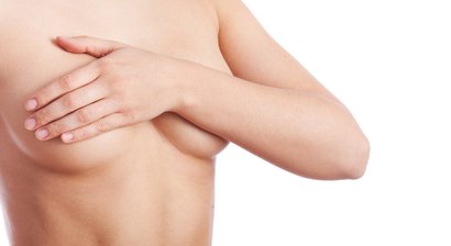 Formkorrektur der Brust bei Fehlbildungen und Asymmetrien