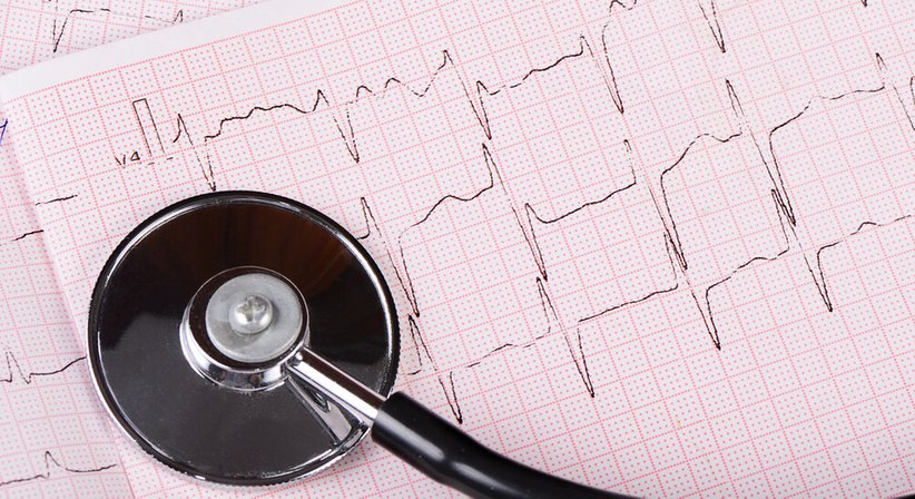 Event-Recorder (Ereignisrekorder) - Dr. Tania Fuchs, MSc. - Internistin Klosterneuburg 3400