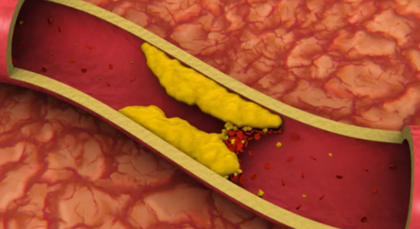 Ultraschall der Becken-Beingefäße (Sonografie der peripheren Gefäße) - Dr. Tania Fuchs, MSc. - Internistin Klosterneuburg 3400