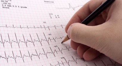 Ruhe-EKG (Elektrokardiografie)