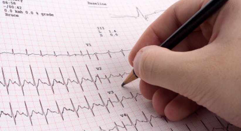 Ruhe-EKG (Elektrokardiografie) - Dr. Tania Fuchs, MSc. - Internistin Klosterneuburg 3400