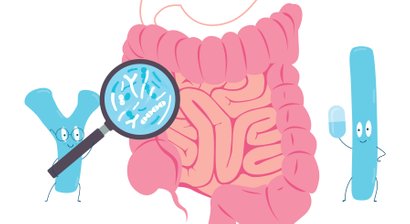 Darmspiegelung/Koloskopie