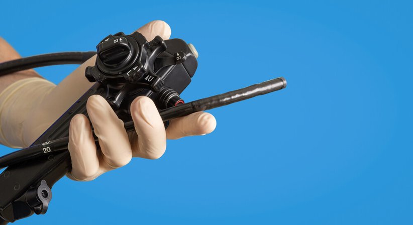  Magenspiegelung/Gastroskopie - Dr. Kurosch Borhanian - Allgemeinchirurg/Viszeralchirurg Salzburg 5020