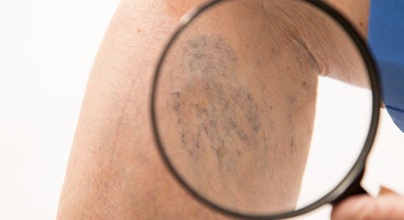 Besenreiser  - Dr. Kurosch Borhanian - Allgemeinchirurg/Viszeralchirurg Salzburg 5020