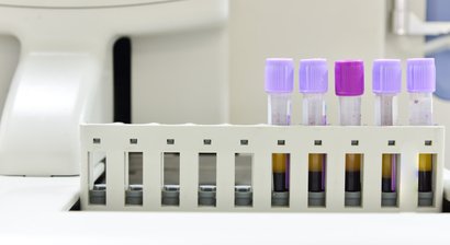 PRP-Therapie (Vampirlift)