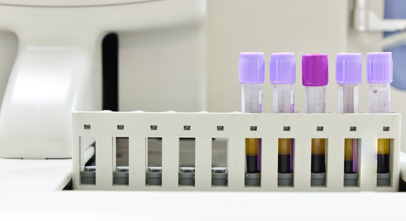 PRP-Therapie (Vampirlift) - Dr. Jennifer Kager - Allgemeinchirurgin/Viszeralchirurgin Krems 3500