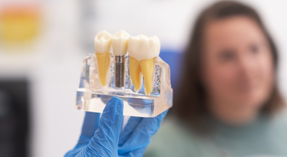 Implantologie / Zahnimplantate