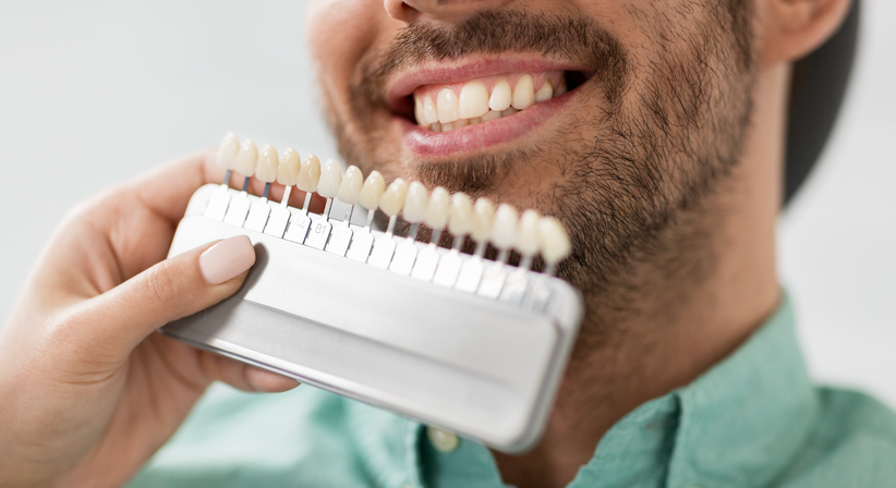 Funktionelle ästhetische Zahnheilkunde / Kronen, Inlays, Veneers etc. - Dr. Barbara Susanne Matejka - Zahnärztin Wien 1070