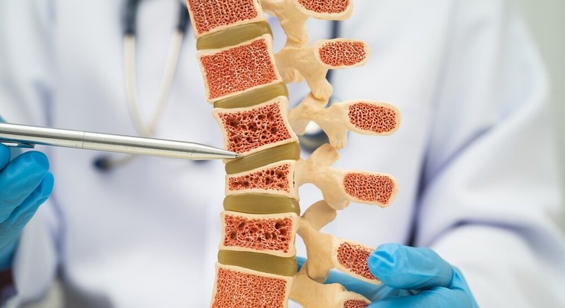 Knochendichtemessung bei Dr. Jakob Ebner