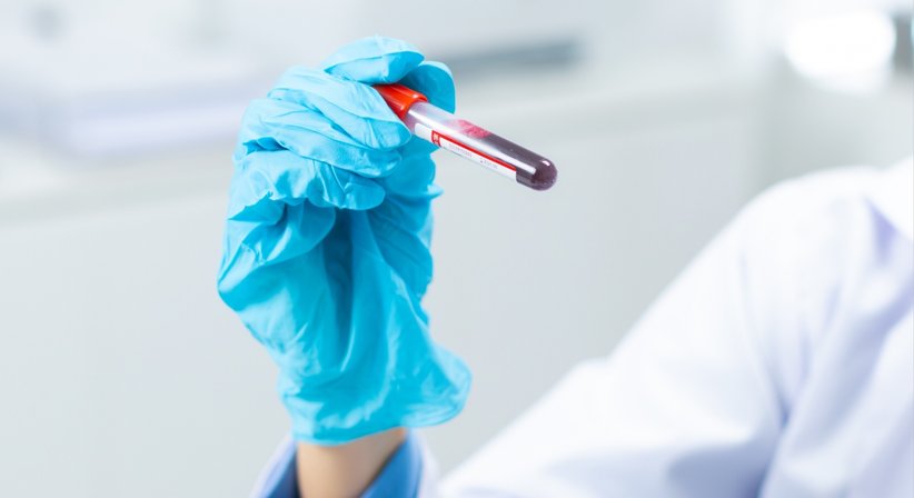 Labor- & Stoffwechseldiagnostik bei Dr. Jakob Ebner