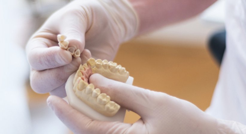 Zahnersatz - DDr. Alexander Hadwig - Zahnarzt Wien 1090