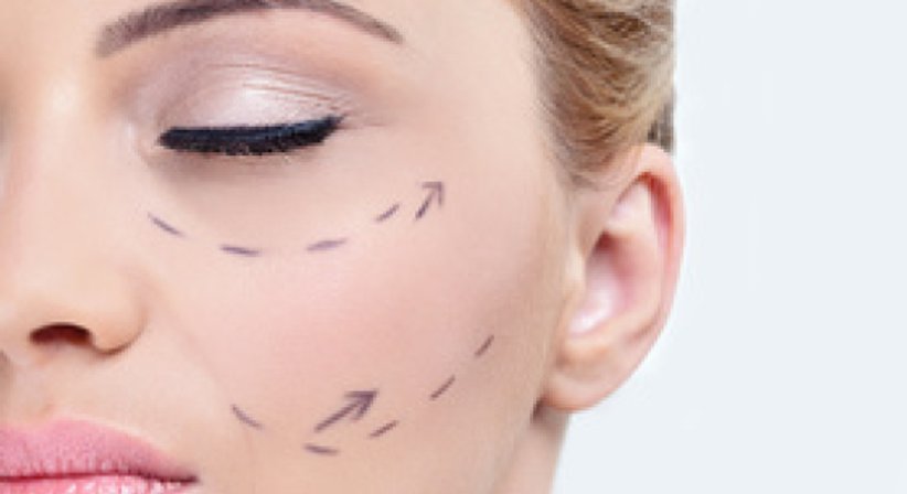 Facelift - Dr. med. univ. Ali Saalabian - Plastischer Chirurg Wien 1010