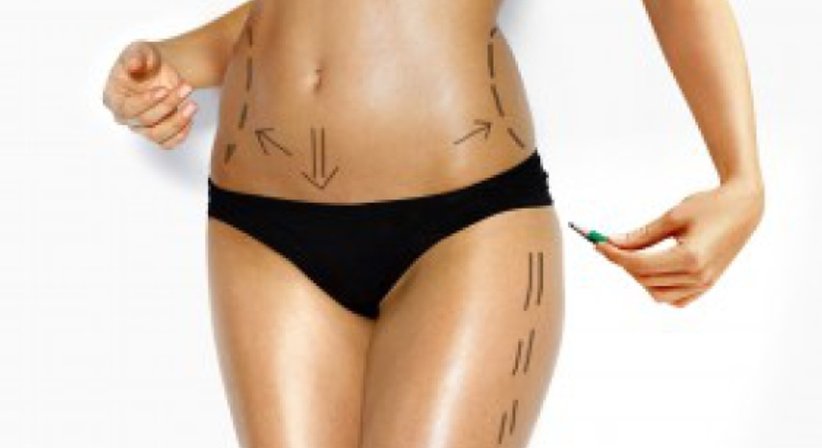 Hautstraffung - Dr. med. univ. Ali Saalabian - Plastischer Chirurg Wien 1010