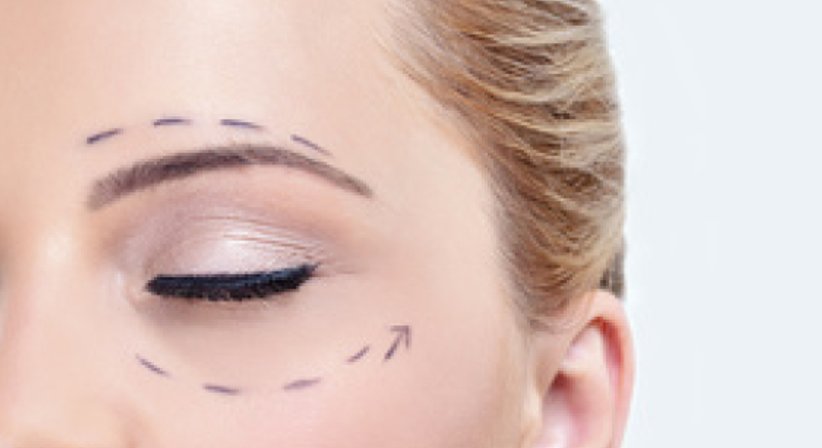 Lidkorrektur - Dr. med. univ. Ali Saalabian - Plastischer Chirurg Wien 1010