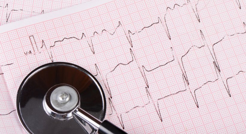 EKG - Dr. Marcus Franz, MSc - Internist Wien 1130