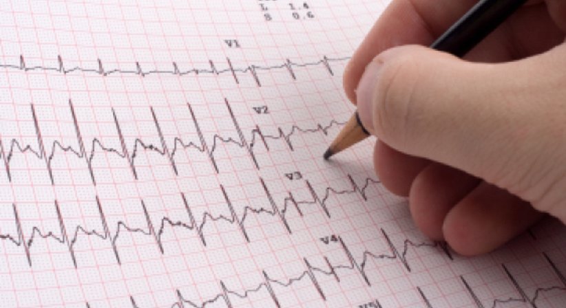 Langzeit-EKG - Dr. Marcus Franz, MSc - Internist Wien 1130