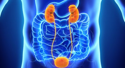 Nieren- und Harnleitersteine