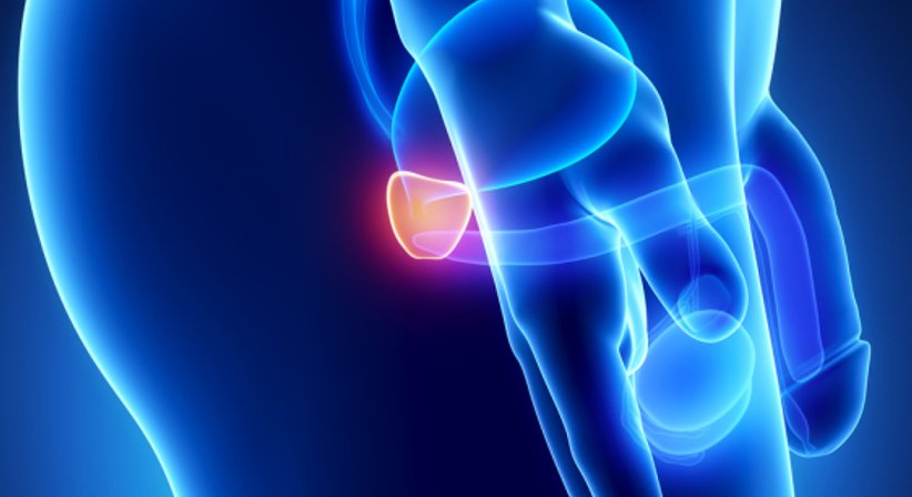Prostata - Priv.Doz. Dr. Jörg Schmidbauer, F.E.B.U. - Urologe Wien 1130