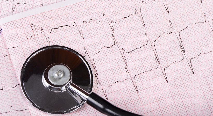 EKG - Dr. Arash Pourkarami - Praktischer Arzt Wien 1220