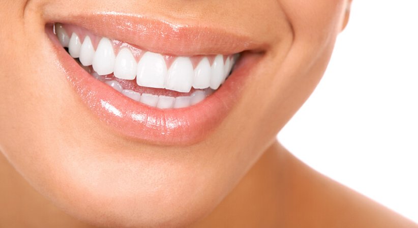 Ästhetische Füllungstherapie (Weiße Füllung, Kompositfüllung) - Dr. Elke Lenotti - Zahnärztin Wien 1020