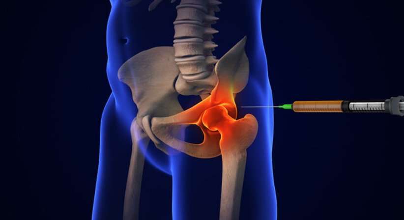 Hyaloronsäuretherapie - Dr. Sabine Streubel - Unfallchirurgin Ladendorf 2126