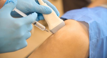 Ultraschall gezielte Infiltration