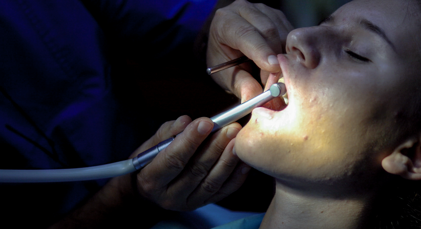 Wurzelspitzenresektion - Dr. Alexander Puchner, MSc - Zahnarzt Neunkirchen 2620