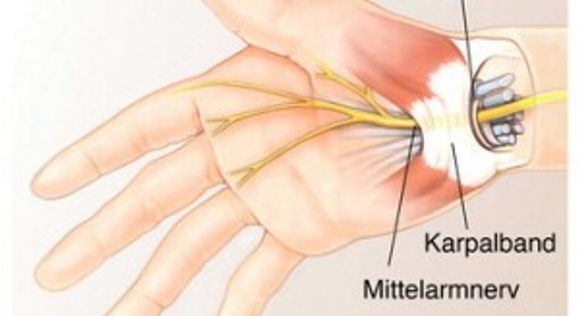 Handchirurgie - Dr. Matthias Kolloros - Plastischer Chirurg Klagenfurt 9020