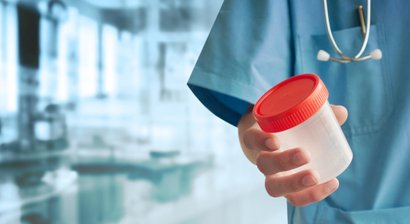 Proteinurie (Eiweiß im Harn)