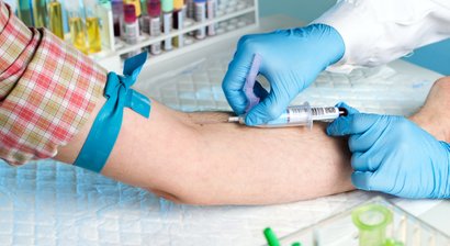 Hämaturie (Blut im Harn)