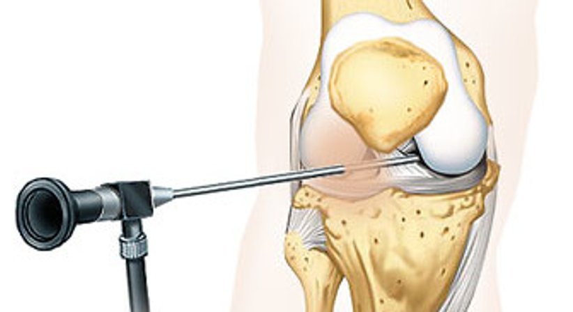 Arthroskopie, Meniskusriss, Kreuzbandriss - OA Dr. Michael Yaser Akta - Orthopäde Wien 1070