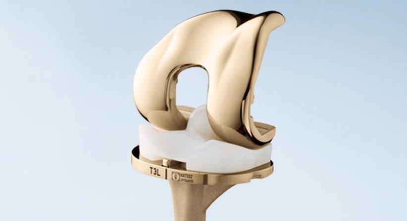 Knieprothese, Massgeschneidet - OA Dr. Michael Yaser Akta - Orthopäde Wien 1070