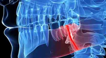 Endodontie : Wurzelbehandlungen
