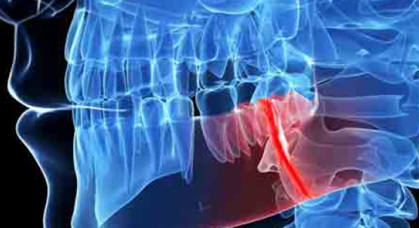 Endodontie : Wurzelbehandlungen - Univ. Med. Dr. Wolfgang Hassler - Zahnarzt Wien 1010