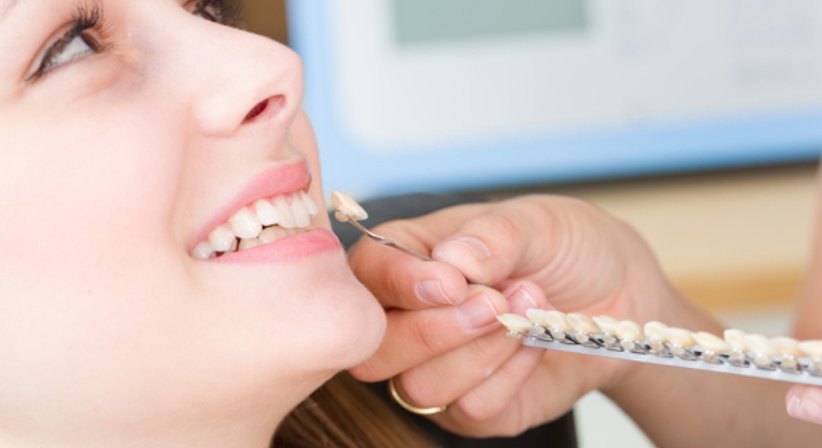 Veneers - Dr. Martin Ladentrog - Zahnarzt Graz 8010