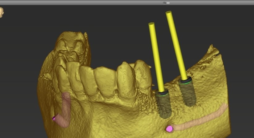 3D-Röntgen / DVT - Zahnärztin Petra Sulik, M.Sc. - Zahnärztin Schwanenstadt 4690