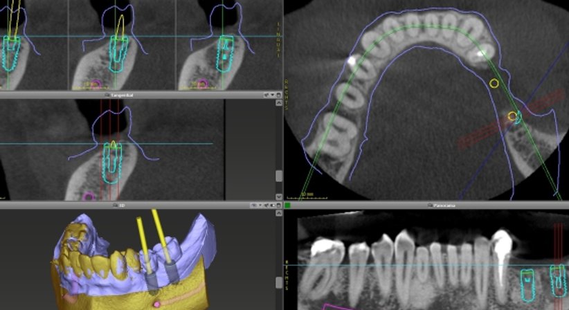 3D-Röntgen / DVT - Zahnärztin Petra Sulik, M.Sc. - Zahnärztin Schwanenstadt 4690