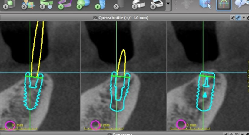 3D-Röntgen / DVT - Zahnärztin Petra Sulik, M.Sc. - Zahnärztin Schwanenstadt 4690