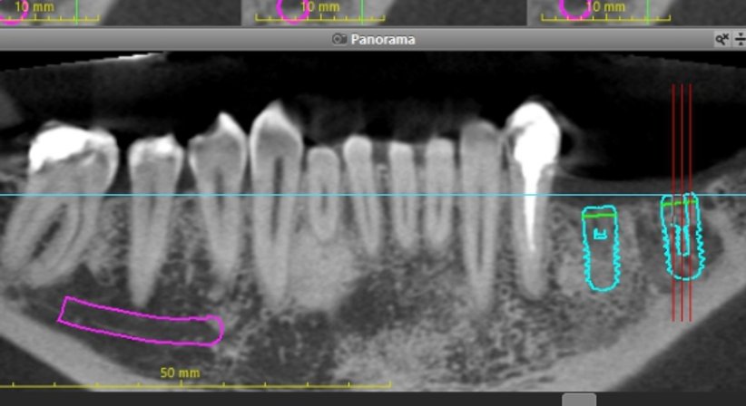 3D-Röntgen / DVT - Zahnärztin Petra Sulik, M.Sc. - Zahnärztin Schwanenstadt 4690