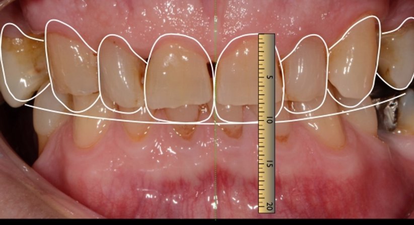 Zahnästhetik - Zahnärztin Petra Sulik, M.Sc. - Zahnärztin Schwanenstadt 4690