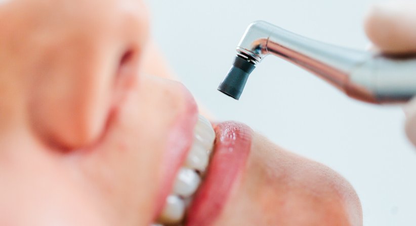 Prophylaxe und Mundhygiene  - MDDr. Antonia Kupec - Zahnärztin Dornbirn 6850