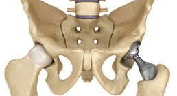 OA Dr. Patrick Niederle - Orthopäde Gerasdorf 2201
