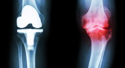 OA Dr. Mark Schurz - Orthopäde Wien 1090