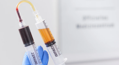 Eigenbluttherapie - ultraschallgezielte Eigenbluttherapie