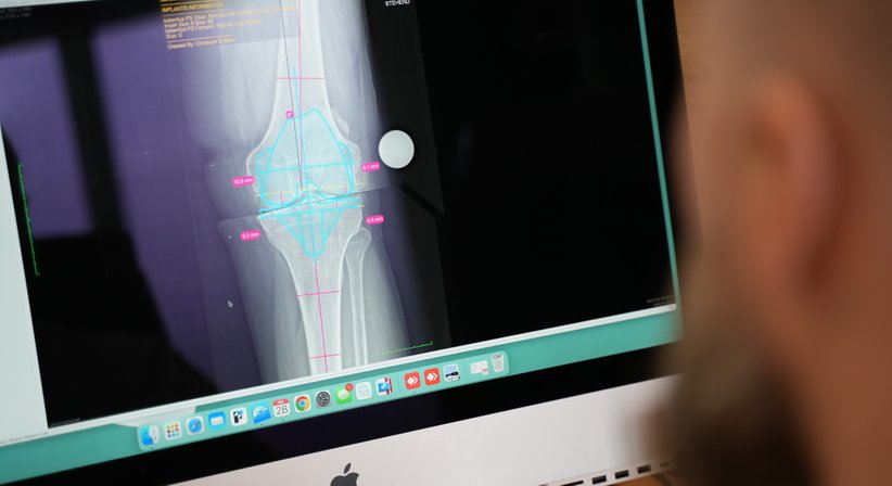 Endoprothetik - Ortho Implant Plus - Dr. Christoph Gröbner - Unfallchirurg Rohrbach-Berg 4150