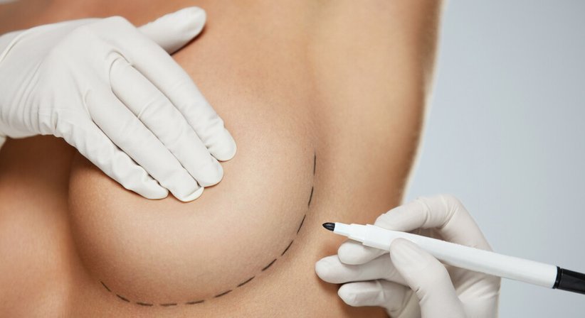 Brustchirurgie - Dr. Daniela Rieder - Plastische Chirurgin Krems 3500