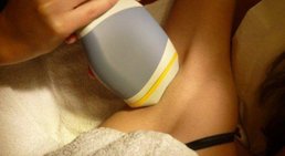 Dauerhafte Haarentfernung mittels IPL-Verfahren -