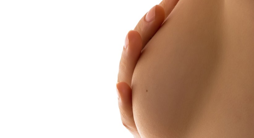 Brustoperation - OA Dr. Wolfgang Rohrbacher - Plastischer Chirurg Wien 1130