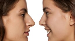 Nase -